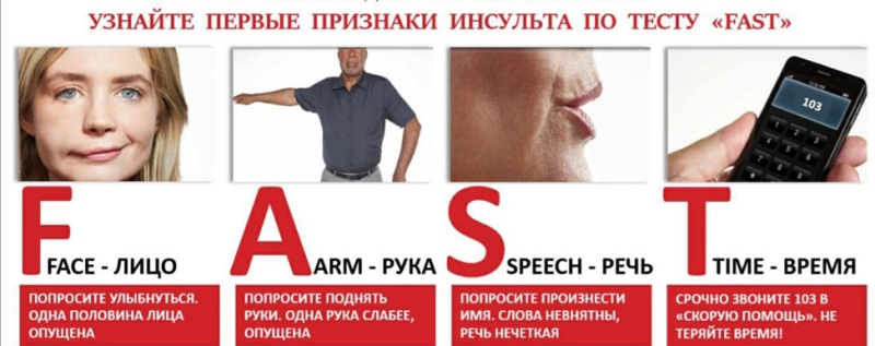 Врачи Регионального сосудистого центра о порядке действий при подозрении на инсульт